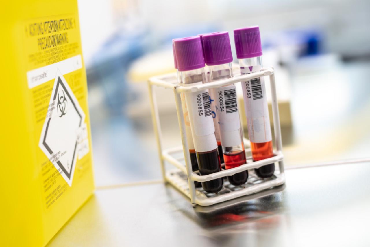 трамп запретил финансирование исследований опасных вирусов