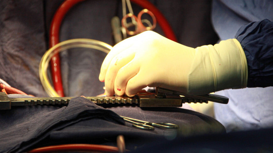 врачи в казахстане спасли женщину с аномально большим языком