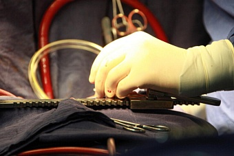 врачи в казахстане спасли женщину с аномально большим языком