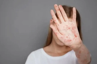 заслон заразе: в таджикистане массово ставят прививки от двух опасных вирусных заболеваний