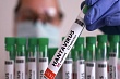новый случай заражения хантавирусом и вспышка эболы встревожили весь мир: хроника распространения вирусов (18 мая)