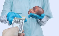 Как казахстанцы продают почки в соцсетях и зарабатывают тюремные сроки