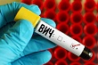 в казахстане меняют правила проведения мероприятий по профилактике вич-инфекции 