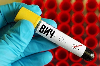 в казахстане меняют правила проведения мероприятий по профилактике вич-инфекции 