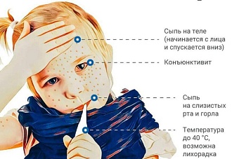 в кыргызстане врачи и медсестры готовятся ко второму этапу иммунизации против кори